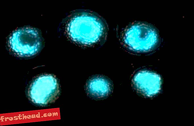 светящиеся микробные шарики.jpg