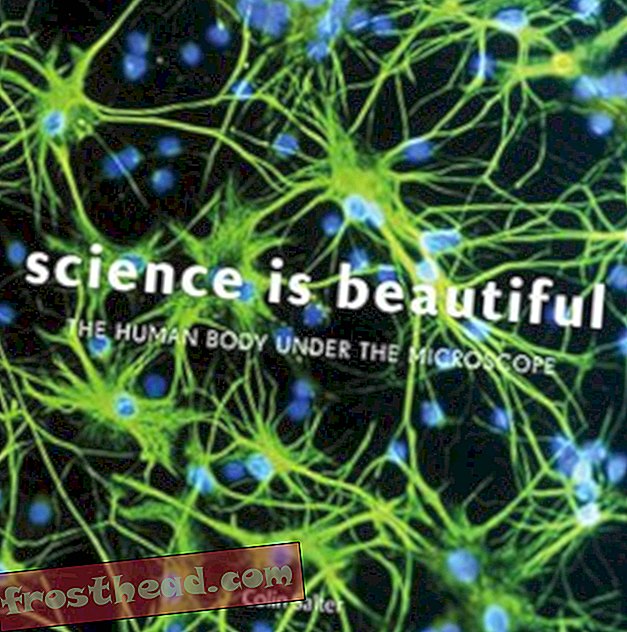 статии, изкуства и култура, книги, наука, ум и тяло - Кръвните съсиреци, чернодробните клетки и птичият грип са изненадващо красиви под микроскоп