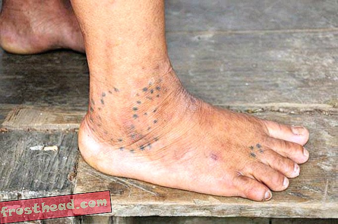 Léčivé kloubní tetování kajani