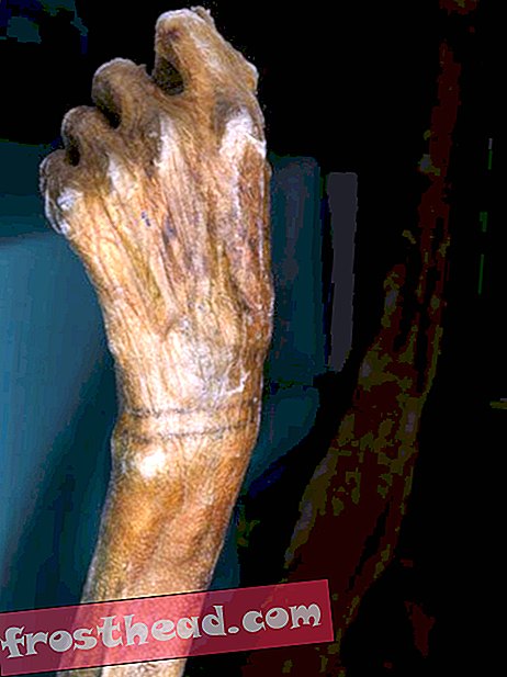 Tatouage en forme de bracelet de l'homme des glaces âgé de 5 300 ans