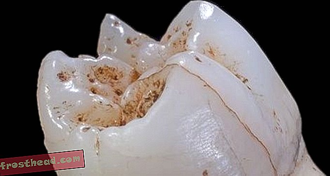 Tooth Chemistry potwierdza, że ​​mięso Homo Loved Loved