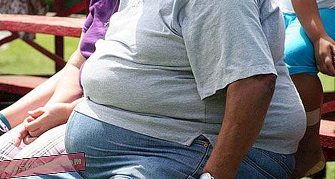 Υπάρχουν περισσότερα για την παχυσαρκία από ό, τι πάρα πολύ φαγητό;