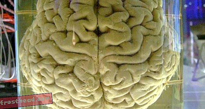 artículos, blogs, innovaciones, innovación, tecnología y espacio - Cuando las computadoras tienen cerebro