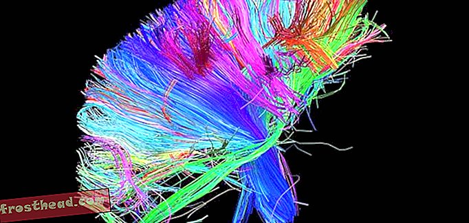 artikkeleita, blogeja, innovaatioita, innovaatioita, tekniikkaa, tiedettä, ihmisen käyttäytymistä, - Voiko aivaskannaus todella kertoa meille, mikä tekee jostakin kauniista?