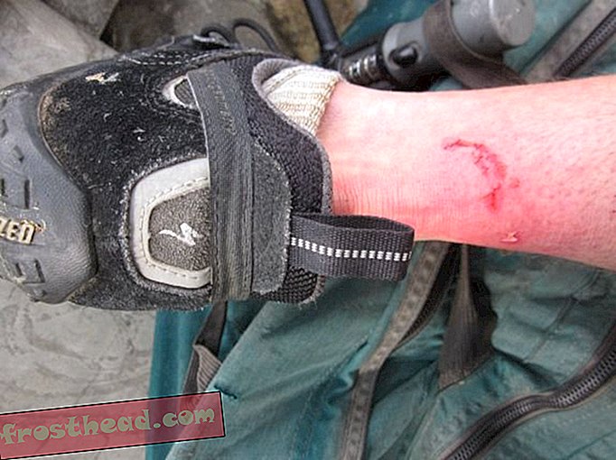 Bicikl, kora, ugriz, krv: opasnosti biciklizma u zemlji bjesnoće