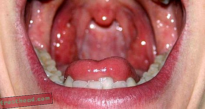 La tua etnia determina le specie di batteri che vivono nella tua bocca