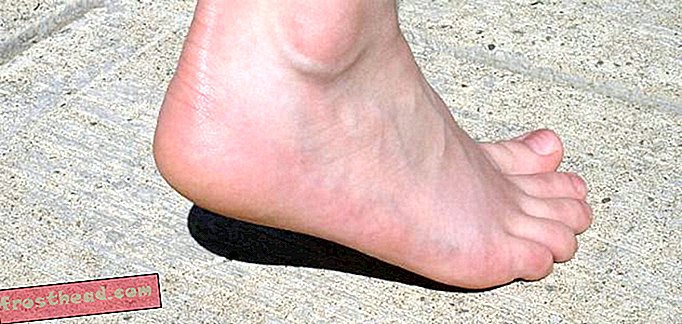 O Barefoot Running é realmente melhor?