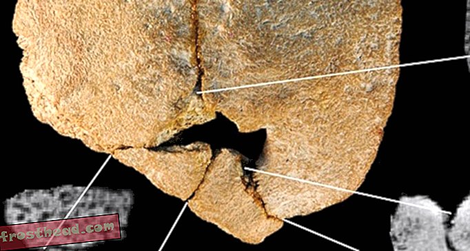 Cráneo humano prehistórico muestra signos de endogamia