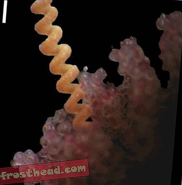 Μια παρασιτική κορδέλα τύπου worm, που φαίνεται σε αυτή την εικόνα με τα αυγά καβουριών, συνεχίζει να υφίσταται.