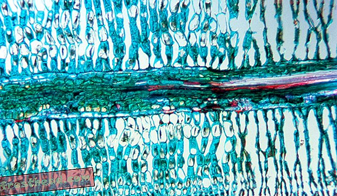 Леко микрографско изображение показва тъканното увреждане на смърчово листо при киселинен дъжд.