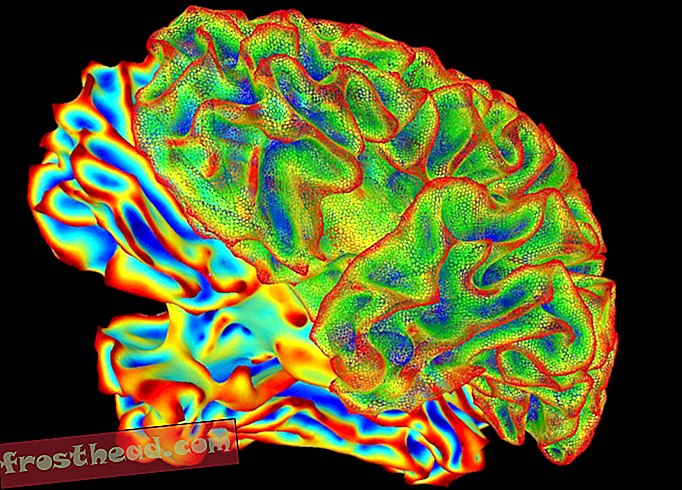 Les implants cérébraux peuvent remettre en forme les souvenirs endommagés