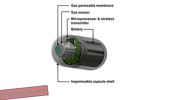 Fekaalne käärimine ja elektroonilised pillid võivad aidata soolestiku gaase dešifreerida
