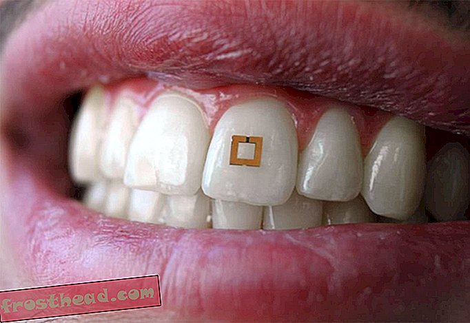 Este pequeño sensor de dientes podría realizar un seguimiento de los alimentos que come
