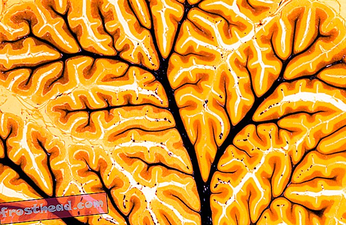 Six façons de stimuler le cerveau par voie électrique pourraient être utilisées à l'avenir
