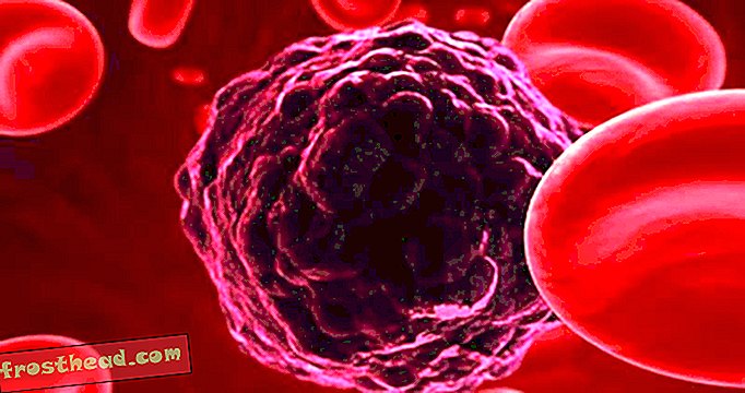 članci, inovacije, zdravlje i medicina - Jesmo li blizu da imamo test krvi koji otkriva rak?