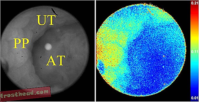 Image polarisée de la tumeur dans le colon de la souris