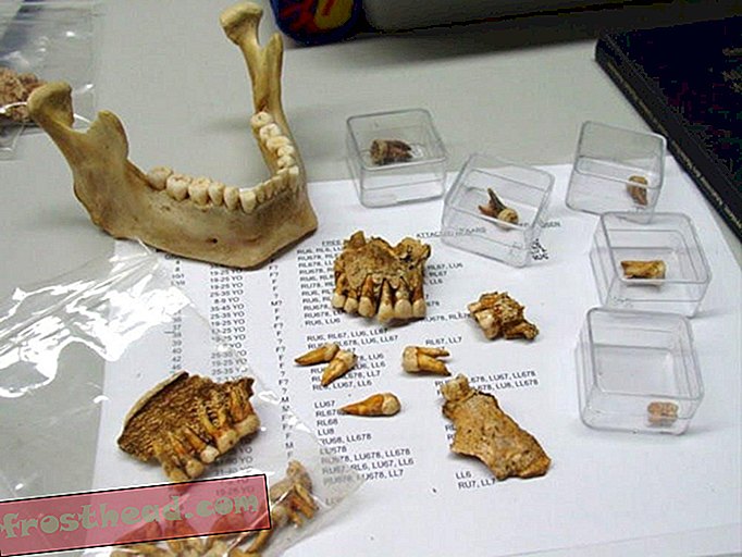 Zuby a kosti z doby železné a bronzové