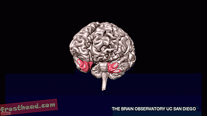 Una autopsia del cerebro más famoso en la historia de la neurociencia