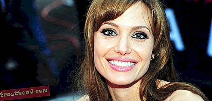 Le choix de la double mastectomie d'Angelina Jolie de plus en plus commun, toujours médicalement sombre