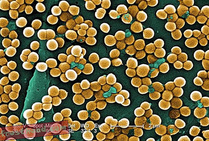 Protein Susu Payudara Boleh Menolong Superbug