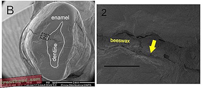 65-годишният пчелен восък може да бъде най-старият известен зъбен пълнеж