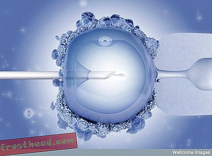 Prva otroška epruveta na svetu danes dopolnjuje 34 let