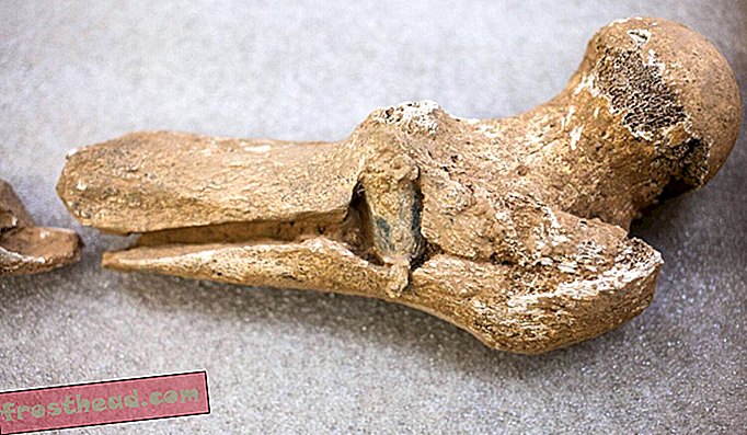 Dit dijbeen werd verwoest door een kogel die in een transversale oriëntatie binnenkwam. Structureel gecompromitteerd door een longitudinale breuk, brak het terwijl het slachtoffer gewicht op zijn been uitoefende.