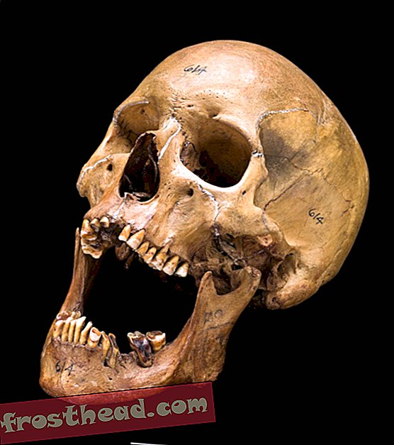 人間の頭蓋骨