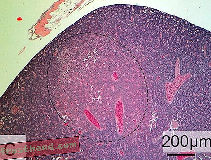 Una vista microscópica del hígado de un pez.