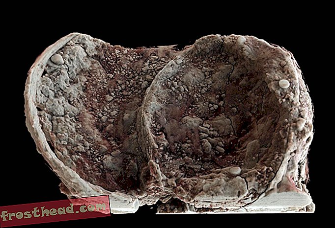 11 Kessel in der Siedlung der Eisenzeit in England gefunden