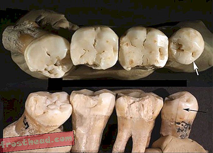 Neandertallased võisid valutavate hammaste raviks kasutada hambaorke
