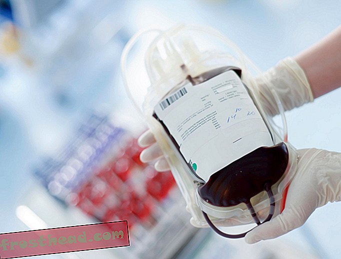 Prije 350 godina, liječnik je izvršio prvu transfuziju ljudske krvi.  Uključena je ovca