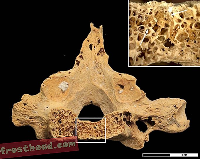 έξυπνες ειδήσεις, έξυπνες ιστορίες ειδήσεων και αρχαιολογία - Αυτός ο 3.000-χρονος ανθρώπινος σκελετός αποκαλύπτει το παλαιότερο γνωστό παράδειγμα καρκίνου