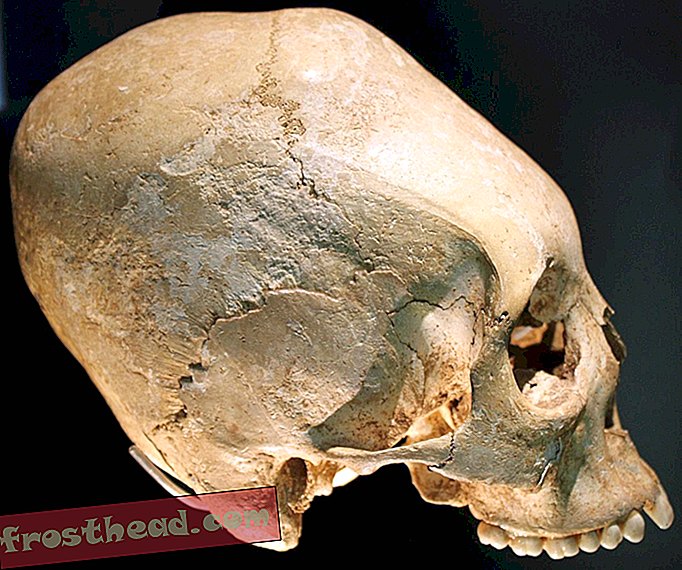 интелигентни новини, история на умни новини и археология - Родителите са прекроили детските си черепи за 45 000 години
