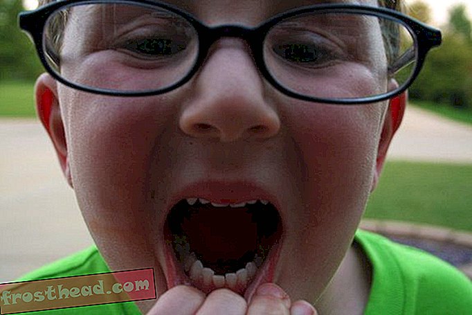 интелигентни новини, идеи за интелигентни новини и иновации - Зъболекарите откриха злополучно свойствата на флуорида, спестяващи зъбите
