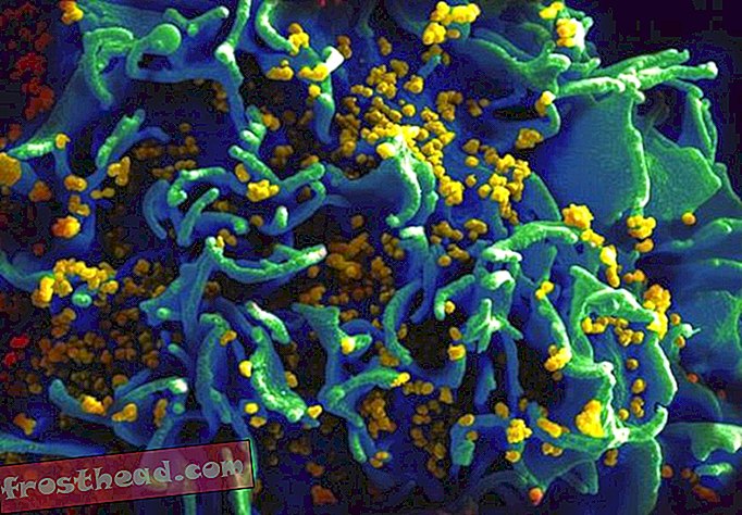 Mehr HIV-Patienten könnten früher behandelt werden