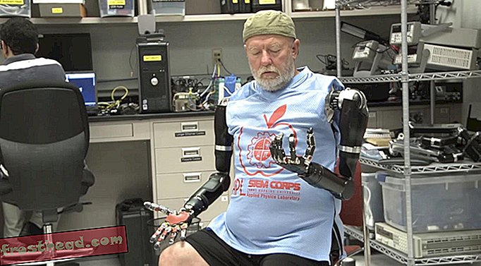 Napredna protetika pomaže psu da trči i čovjeku pomiče robotske ruke svojim umom