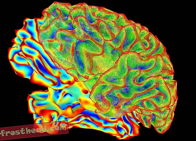 Nouvelles intelligentes, science de l'information intelligente - Une nouvelle étude remet en question la fiabilité de la recherche par scanner cérébral