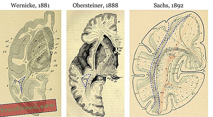 Les neurologues ont perdu la trace d'une partie du cerveau humain et l'ont simplement redécouvert