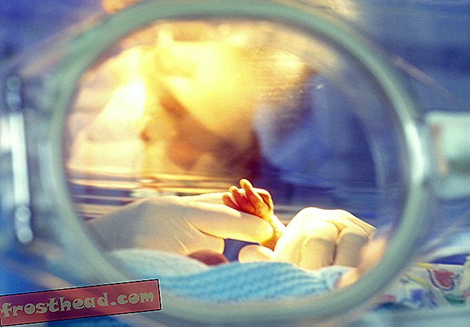 интелигентни новини, умни новини - ХИВ се появи отново в бебето в Мисисипи, което се предполага, че е излекувано от болестта