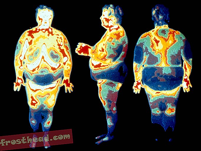 Třetina všech lidí na Zemi trpí nadváhou nebo obezitou