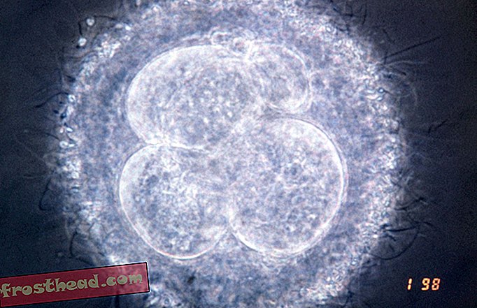 Britanski znanstvenici dobivaju dozvolu za genetski modificiranje ljudskih embrija radi istraživanja
