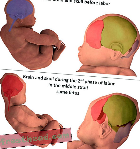 3-डी छवियां दर्शाती हैं कि जन्म के दौरान शिशु का सिर कितना बदलता है