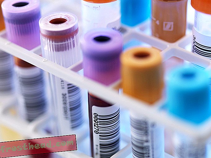 berita pintar, sains berita pintar - Risiko Bunuh Diri Tidak Dapat Diprediksi Melalui Ujian Darah