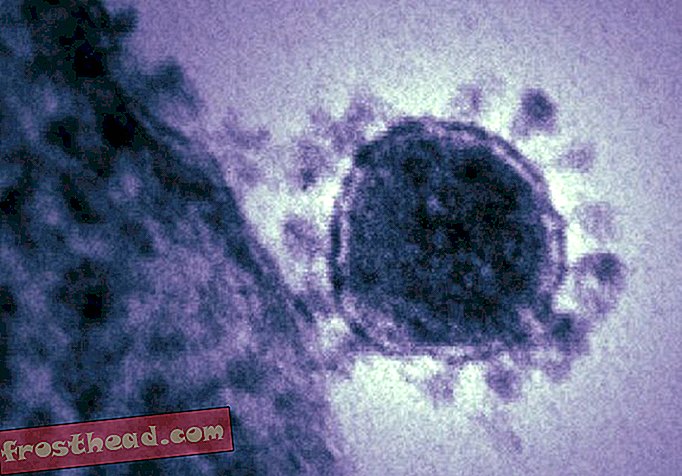 inteligentní zprávy, inteligentní zprávy vědy - Nový virus podobný SARS se šíří - pomalu