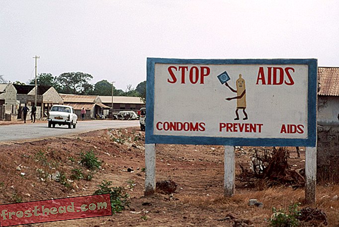 Обрязването може да помогне за разпространението на ХИВ