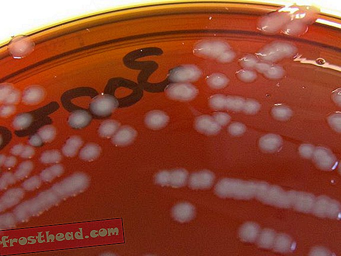 Gonorrhoe mutiert zu einem behandlungsresistenten Superbug