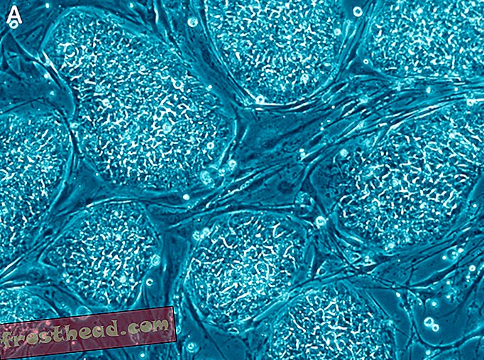pametne vijesti, pametne vijesti - Dva najnovija dobitnika Nobelove nagrade otvorila su Pandorinu kutiju istraživanja i kloniranja matičnih ćelija