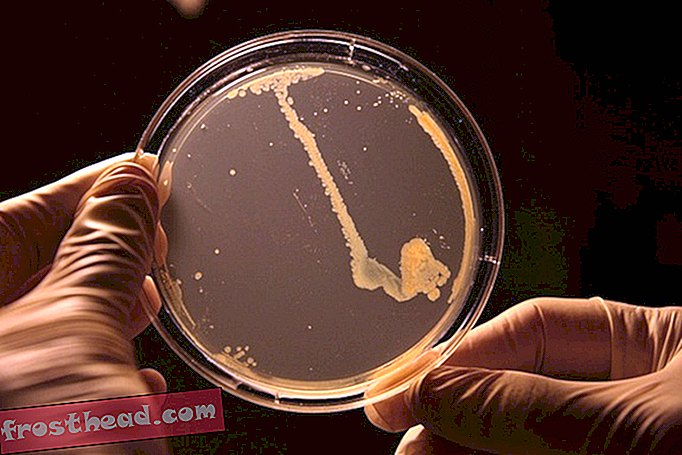 slim nieuws, slim nieuws - Je moet echt bang zijn van de 'Nightmare Bacteria' van de CDC