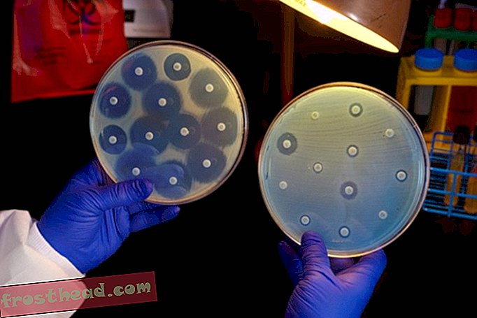 Das ist schlecht: "Nightmare Bacteria" sind häufiger als wir dachten